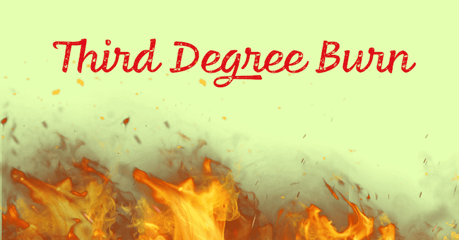 Third Degree Burn - Creative Team Names.